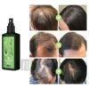100ml-Hair-Growth-Serum-Hair-Lotion-Anti-Hair-Loss-Herbal-HairReBirth-Essence-Spra-Y-Serum-Ginger (4)